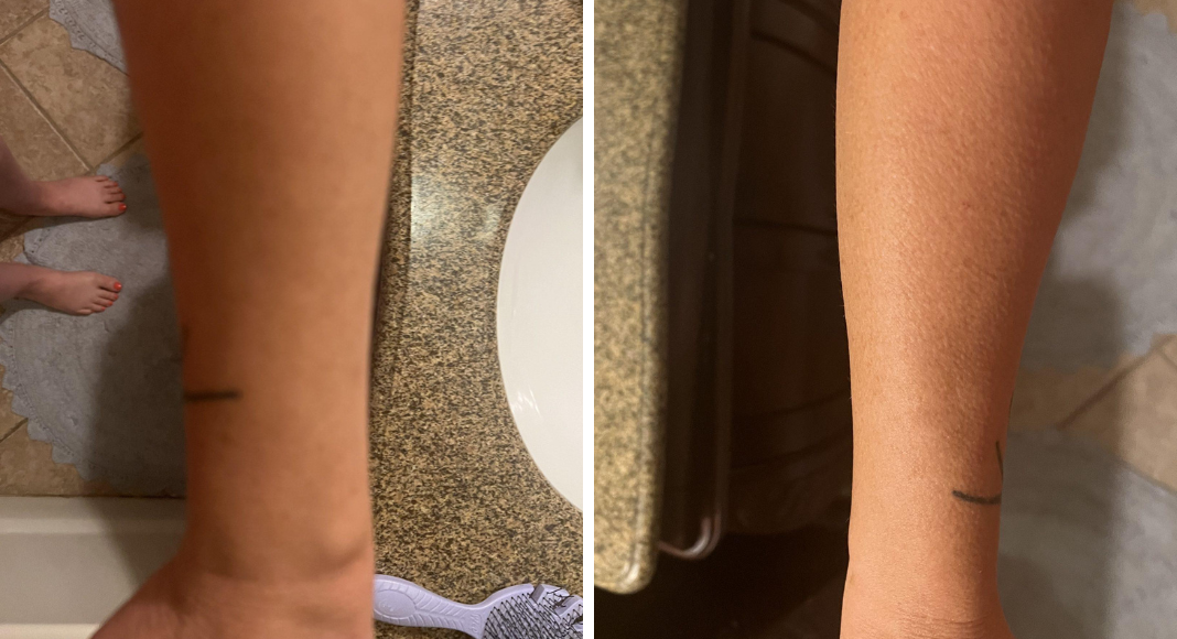 Two pictures of forearms side-by-side after testing two different sunless tanning products.