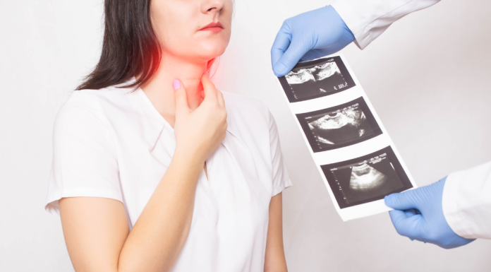 a woman holds her neck, while a doctor's hands holds a sheet of thyroid ultrasound images